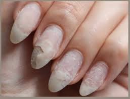 چرا کاشت ناخن هوا میگیرد؟ بررسی علمی + روشهای حرفهای جلوگیری از آن