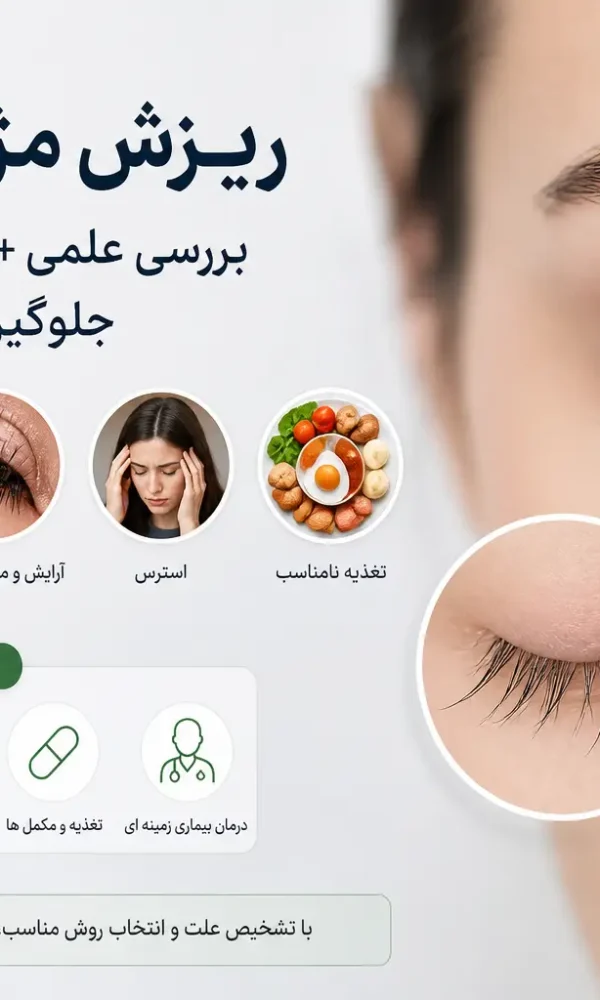 ریزش مژه از چیست؟ بررسی علمی + راهکارهای قطعی جلوگیری و درمان (آپدیت ۱۴۰۵)